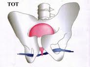 Female Urology