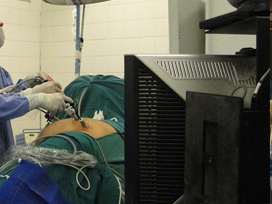 Laparoscopy