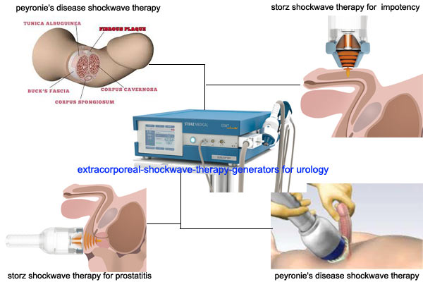 shockwave therapy