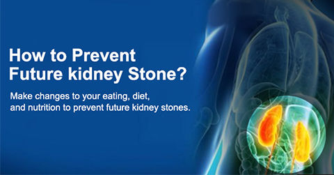 Prevent kidney stone